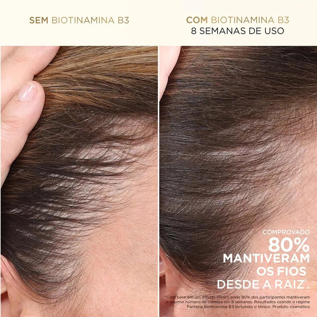 Tônico Capilar Pantene Antqueda Biotinamina B3 52ml